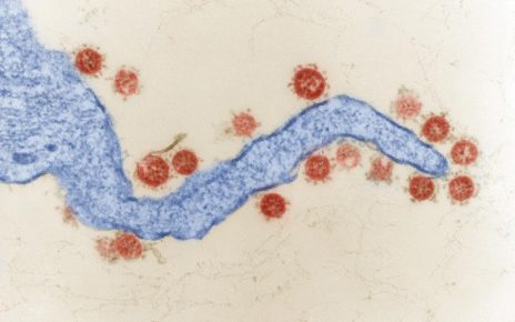 SARS-Coronavirus (Coronaviren). SARS in Vero-Zellen. Transmissions-Elektronenmikroskopie, Ultradünnschnitt; Quelle: Hans R. Gelderblom, Freya Kaulbars/RKI. Kolorierung: Andrea Schnartendorff